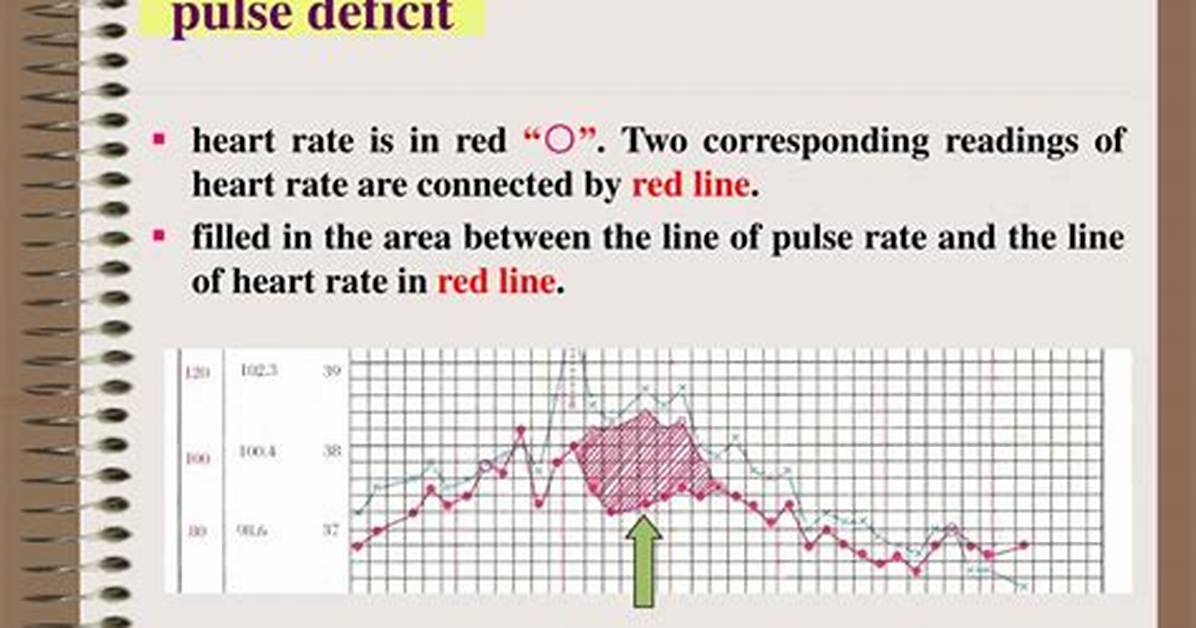 Pulse Deficit Definition