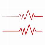 Pulse