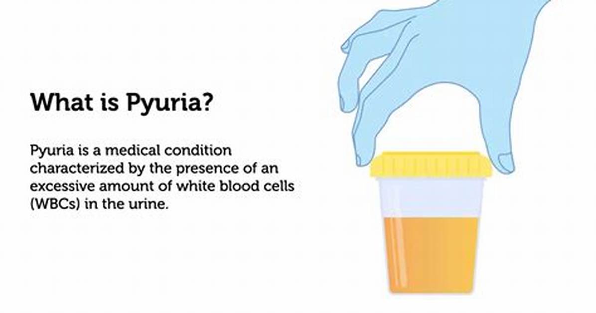 Pyuria Icd 10