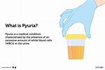 Pyuria Icd 10