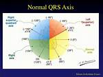 Qrs Axis Normal Range