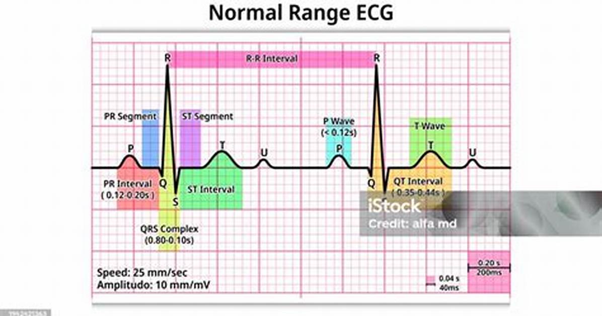 Qrs Normal Range