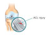 Quick Answer: How Do I Change Acl Permissions in Linux?