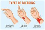 Quick Answer: Which Description Defines a Bleed in an Illustrator Cc Document?