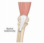 Radial Tuberosity