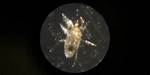 Rat Mites