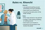 Rhonchi Definition
