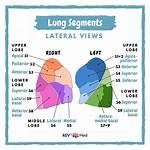 Right Middle Lobe