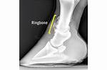 Ring Bone Horse