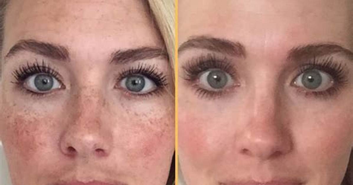 Rodan and Fields Reverse