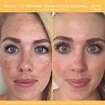 Rodan and Fields Reverse