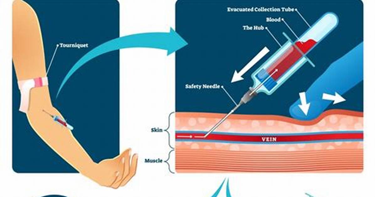 Routine Venipuncture