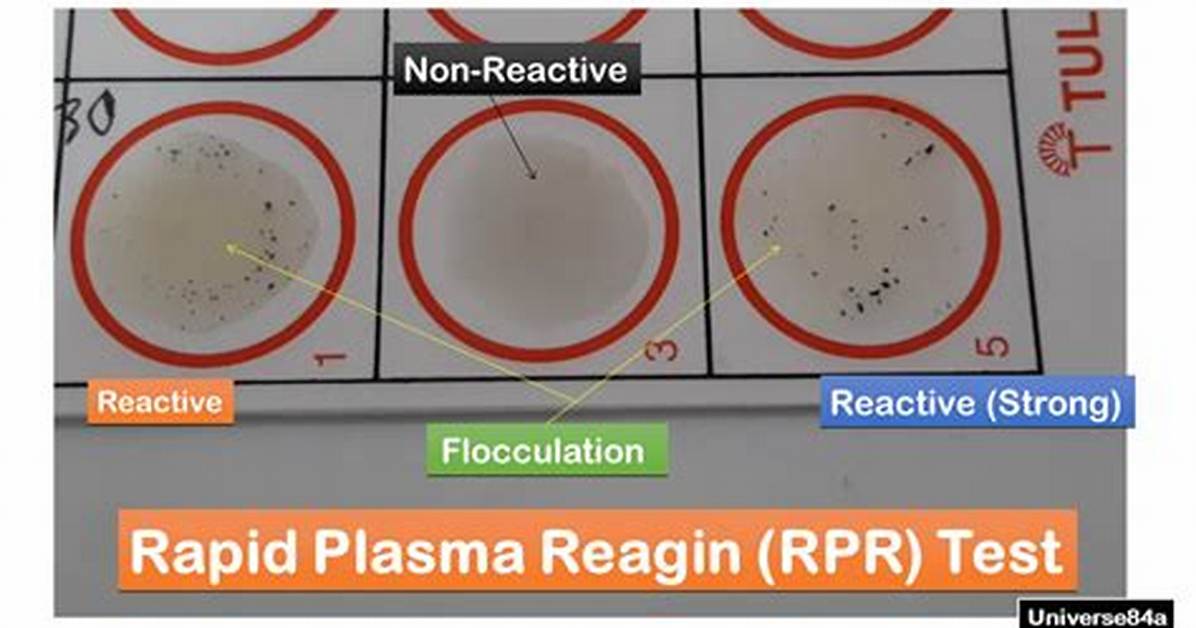 Rpr Full Form