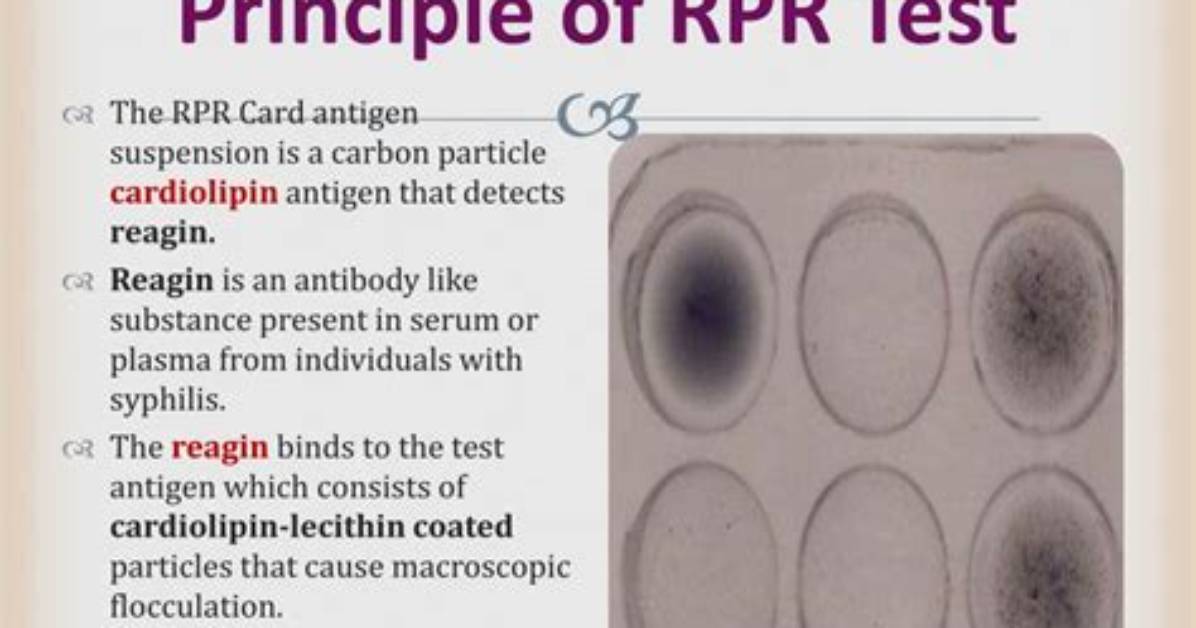 Rpr Meaning