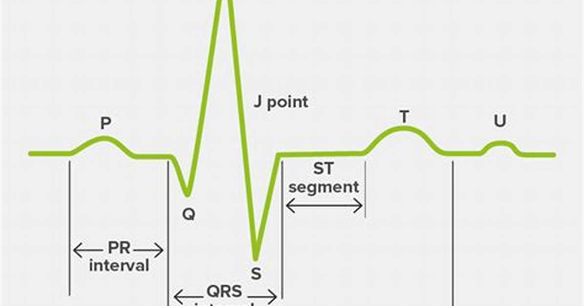 S Wave Ecg