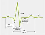 S Wave Ecg