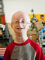Sam Berns
