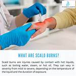 Scald