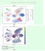 Scanpy - Single-Cell Rna Sequencing - Pre-Processing of Individual Vs. Integrated Dataset