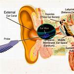 Sedation for Ear Wax Removal?