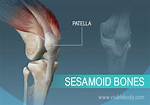 Sesamoid Bone Examples