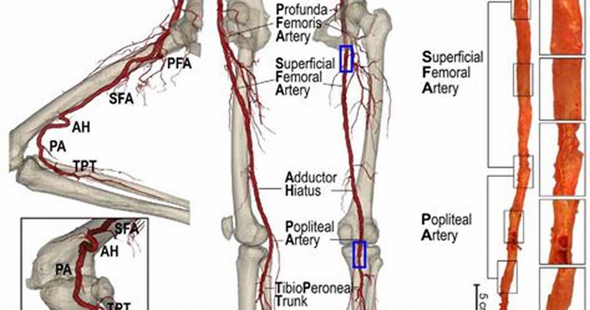 Sfa Artery