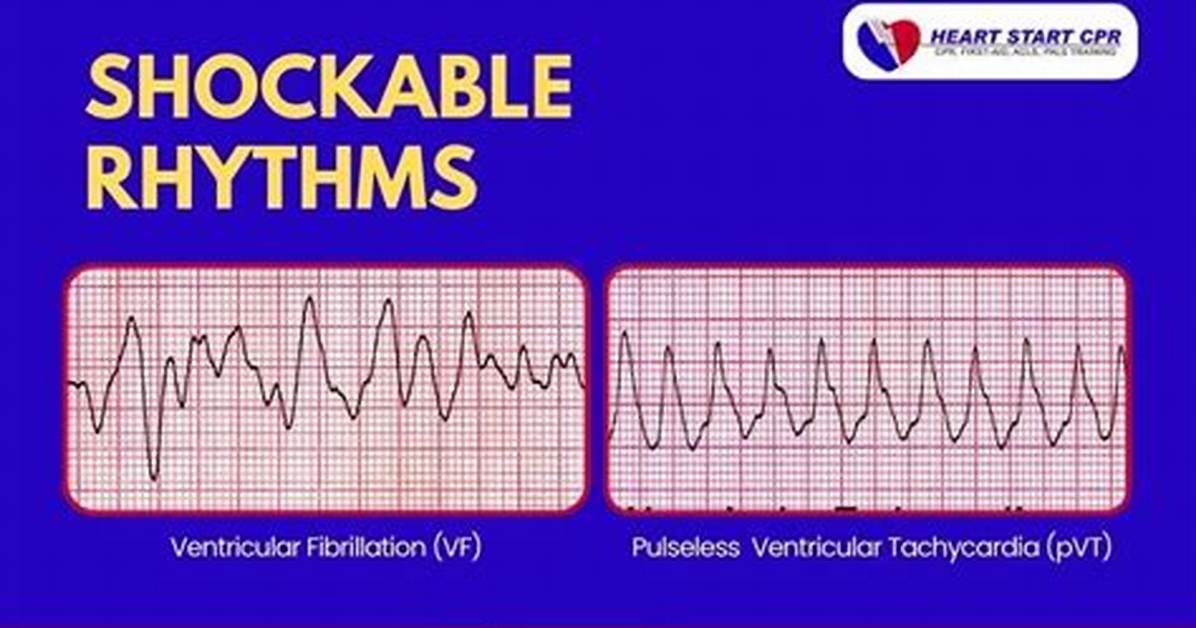 Shockable Heart Rhythms