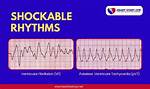 Shockable Heart Rhythms