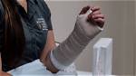 Short Arm Splints