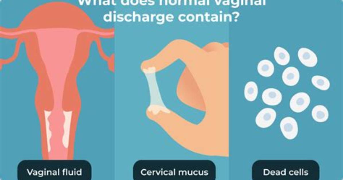 Should Discharge Be Clumpy?