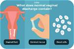 Should Discharge Be Clumpy?