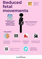 Should Fetal Movement Decrease?