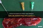 Should Gallbladder Polyps Be Removed?