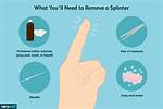 Should I Do Splinter?