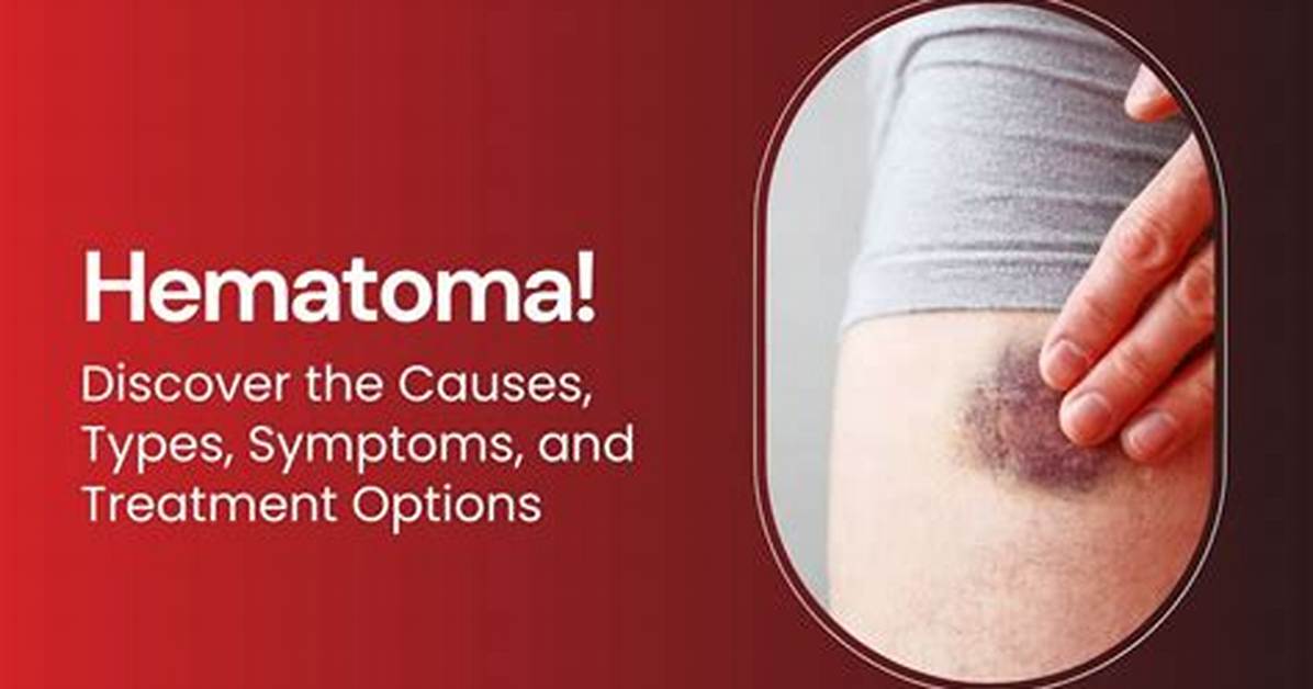 Should Large Hematomas Be Drained?