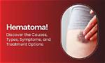 Should Large Hematomas Be Drained?
