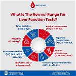 Should Liver Function Tests Be Fasting?