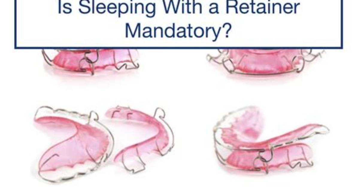 Should Retainers Be Worn While Sleeping?