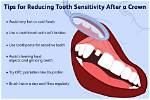 Should Teeth Squeak When Rubbed?