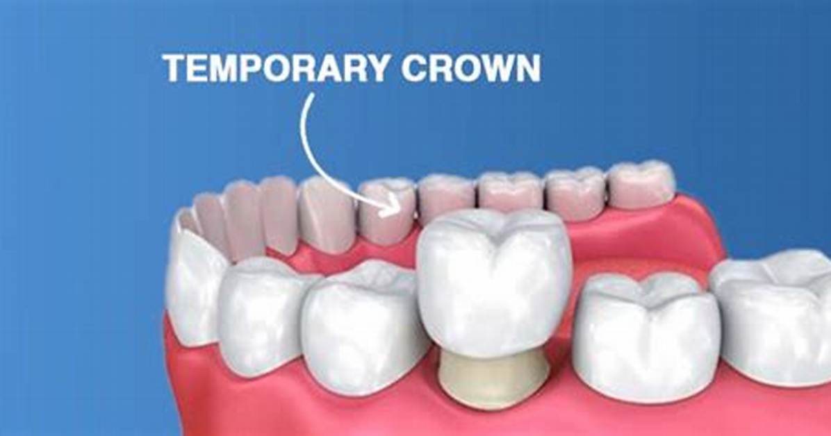 Should Temporary Crown Be Sensitive?