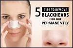 Should We Remove Blackheads?