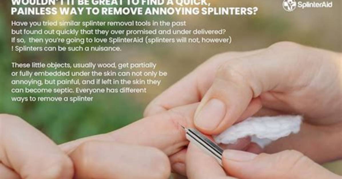 Should You Pull Splinters out?