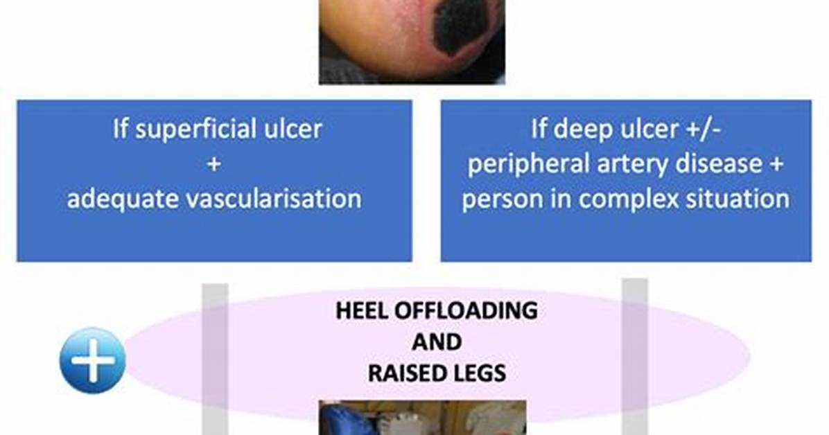 Should You Remove Eschar?