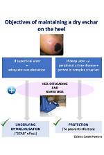 Should You Remove Eschar?
