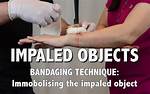 Should You Remove Impaled Object?