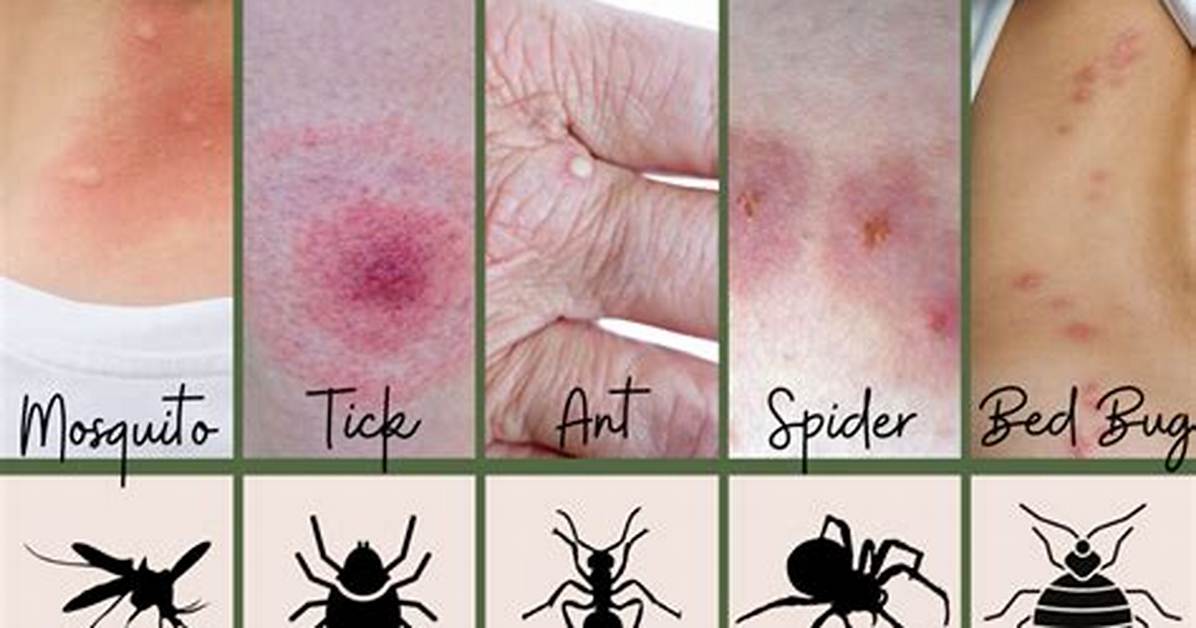 Should You Scratch Bug Bites?