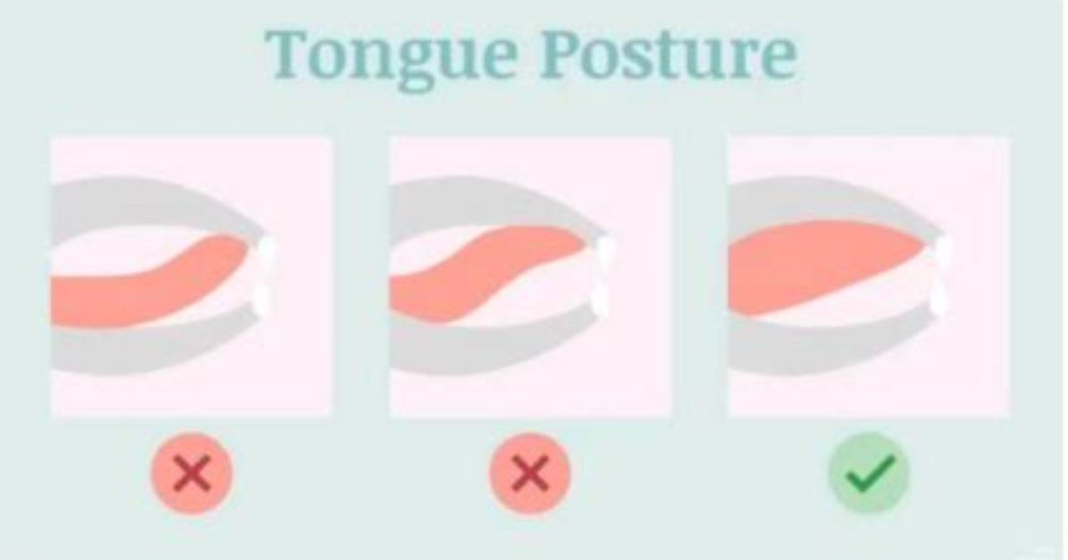 Should Your Teeth Touch?