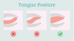 Should Your Teeth Touch?