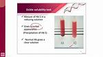Sickle Turbidity Test