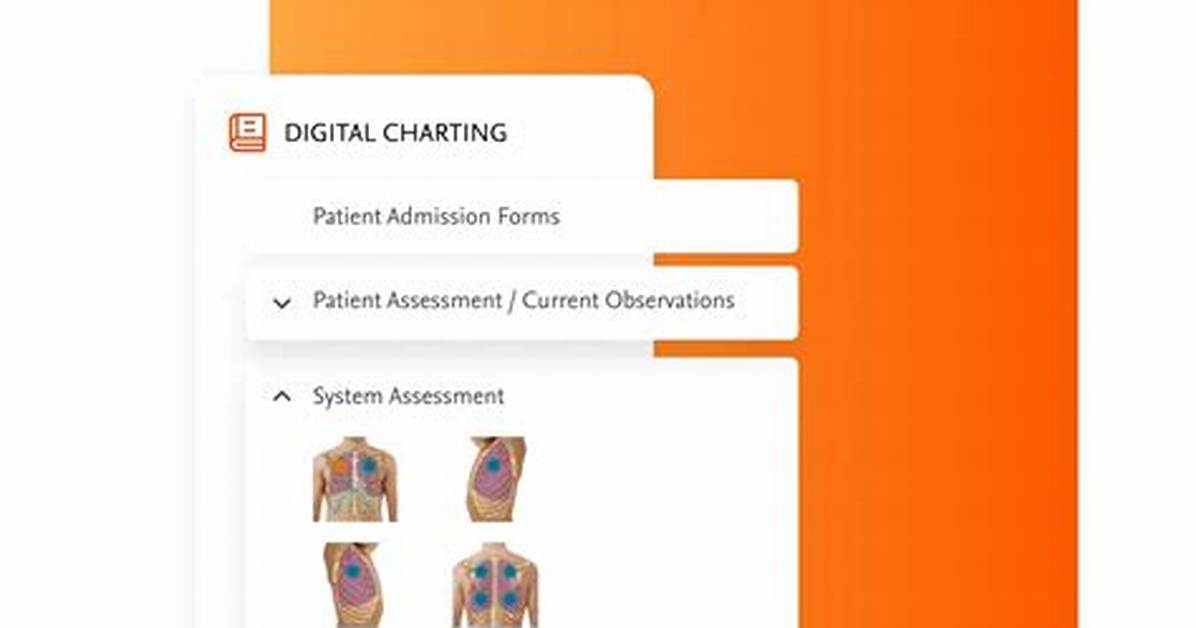 Simchart